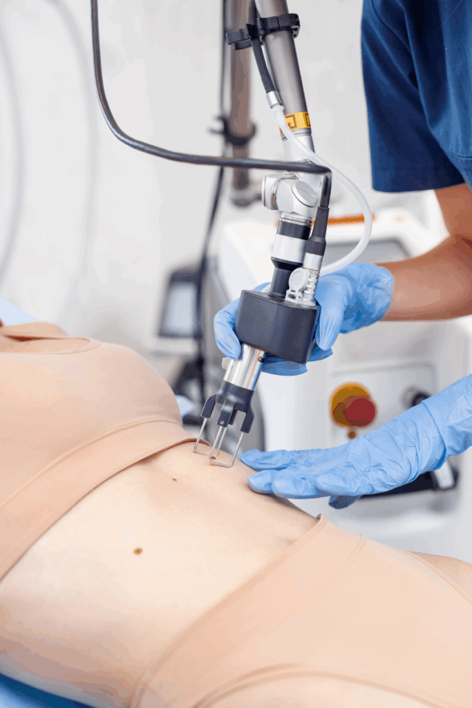 Láser CO2 - Clínica Laderma Dermatología - Alicante